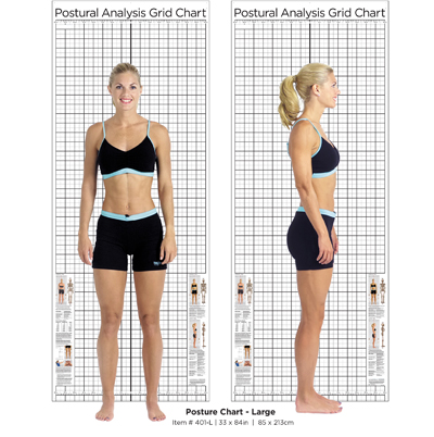 Posture Analysis & Exercise Prescription